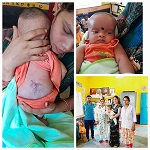 सर्जरी के बाद नन्ही सिद्धि पूरी तरह स्वस्थ, आयुष्मान योजना बनी जीवन संवारने वाली संजीवनी